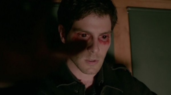 Nick (David Giuntoli) has a bad case of pink eye in 'Mr. Sandman'